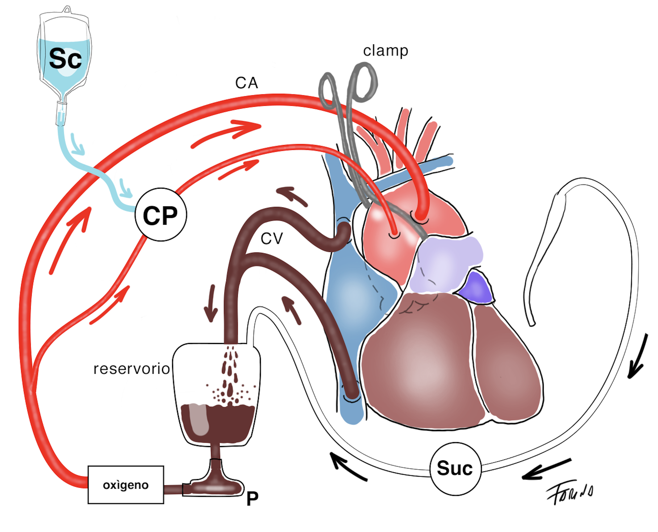 Macchina cuore-polmone
