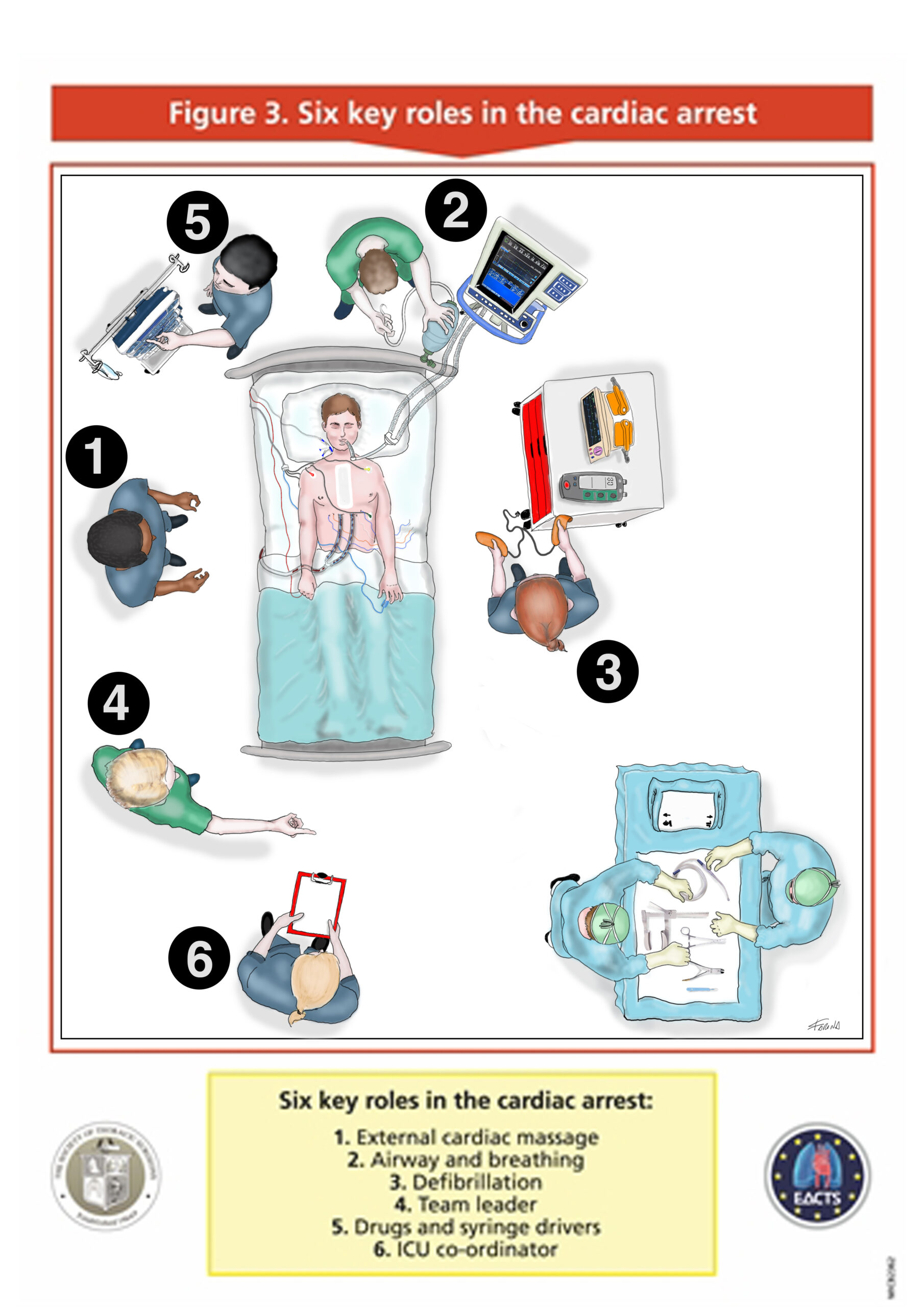 Protocollo CSU-ALS per l’arresto cardiaco post cardiochirurgia